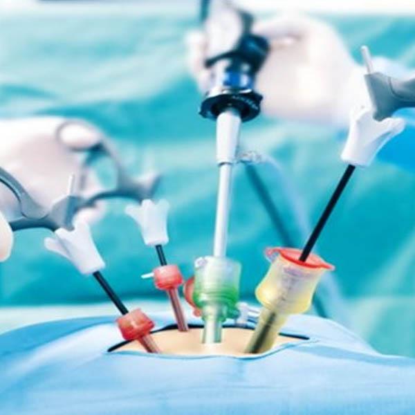 Cirurgia laparoscópica